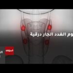 مفهوم الغدد الجار درقية وآلية عملها – الحلقة الكاملة مفهوم الغدد الجار درقية وآلية عملها