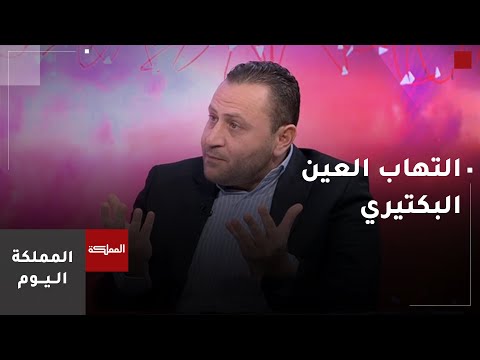 التهاب العين الفيروسي.. كيفية التعامل مع العدوى سريعة الانتشار